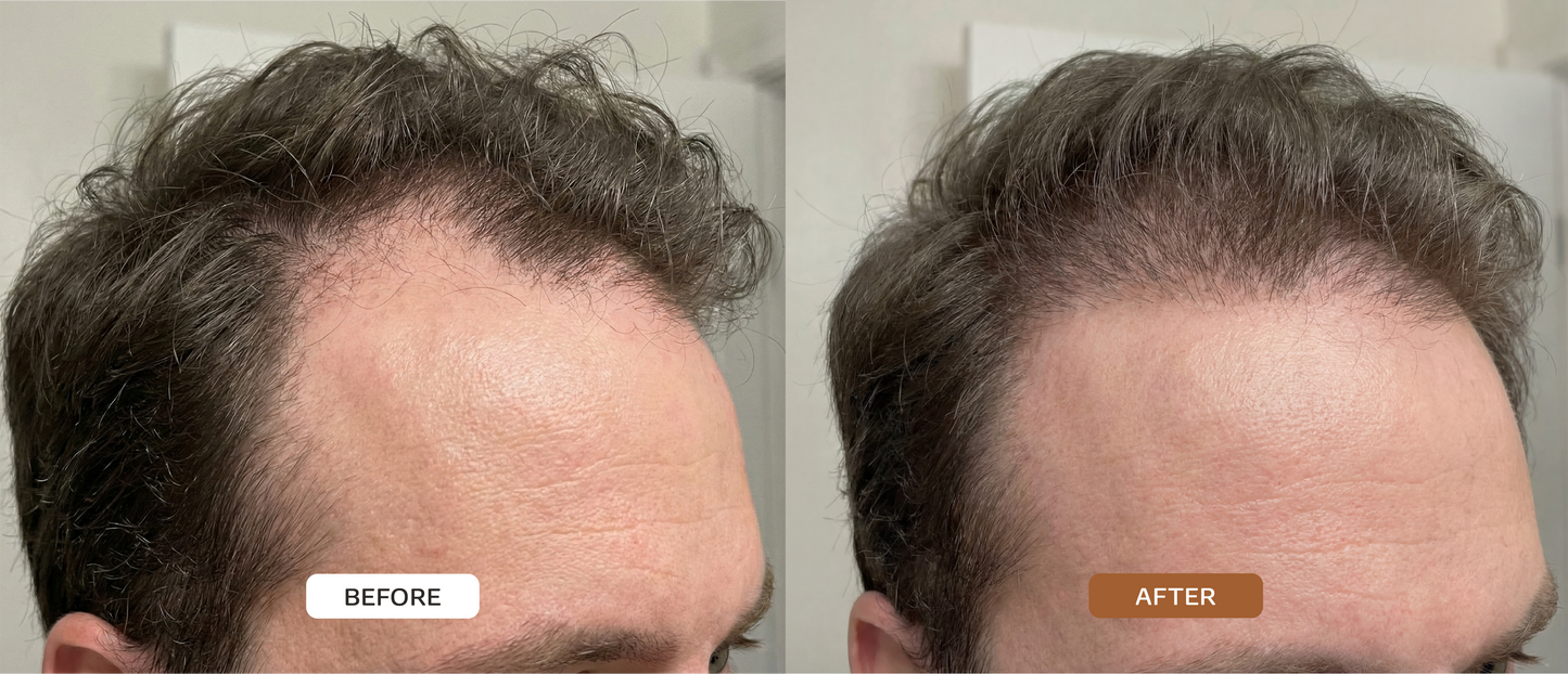 HAIR ACTIVATON SERUM