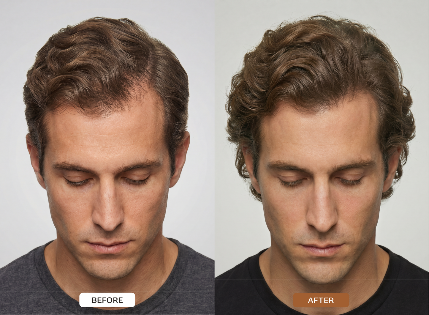 HAIR ACTIVATON SERUM