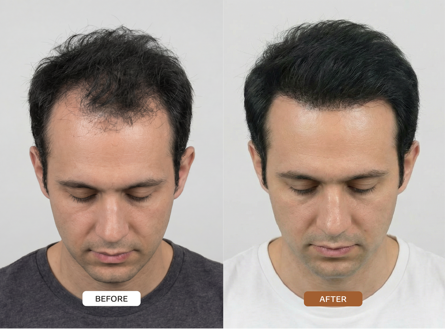 HAIR ACTIVATON SERUM