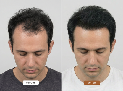 HAIR ACTIVATON SERUM