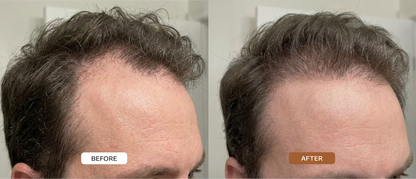 HAIR ACTIVATON SERUM